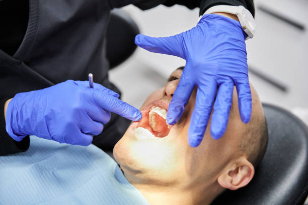 Best Dental Abscess Treatment in Berwyn Heights, MD